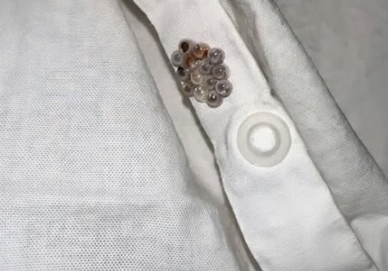 The Absolutely Terrifying Discovery of Those Tiny Mysterious Translucent Balls Clustered in My Bed