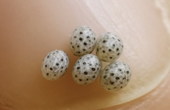 A Dinner That Took an Unexpected Turn: What We Learned After Noticing Something Strange in Our Salad