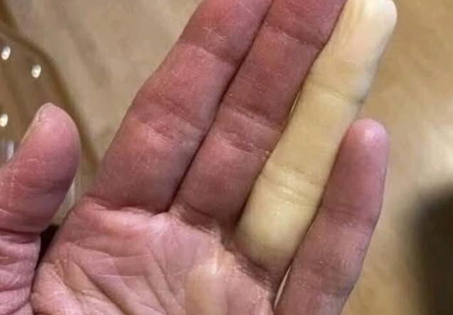 These are the consequences of sleeping with the…