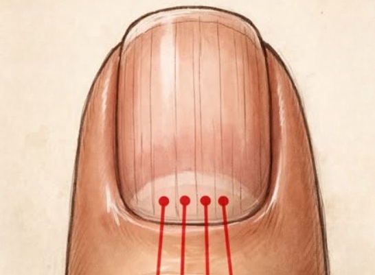 What to Eat to Reduce Nail Ridges: A Complete Nutrition Guide for Stronger, Healthier Nails