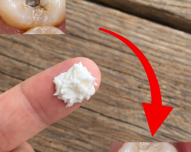 5 Simple Natural Home Remedies to Help Prevent