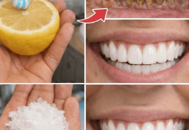 A Gentle Approach to At-Home Teeth Brightening Using Everyday Kitchen Ingredients