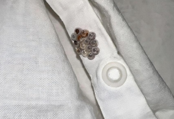The Absolutely Terrifying Discovery of Those Tiny Mysterious Translucent Balls Clustered in My Bed That Nearly Caused Me